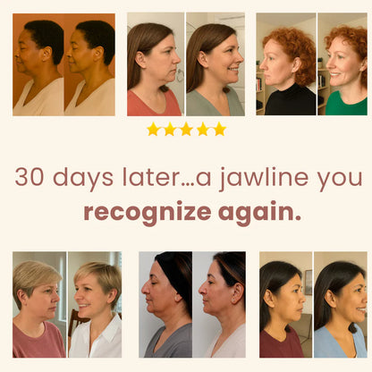 VellureLift™ Jaw/Chin Shaper